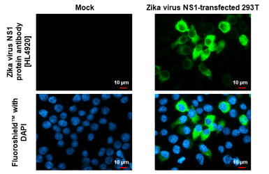Anti-Zika virus NS1 protein antibody [HL4920] used in Immunocytochemistry/ Immunofluorescence (ICC/IF). GTX644993